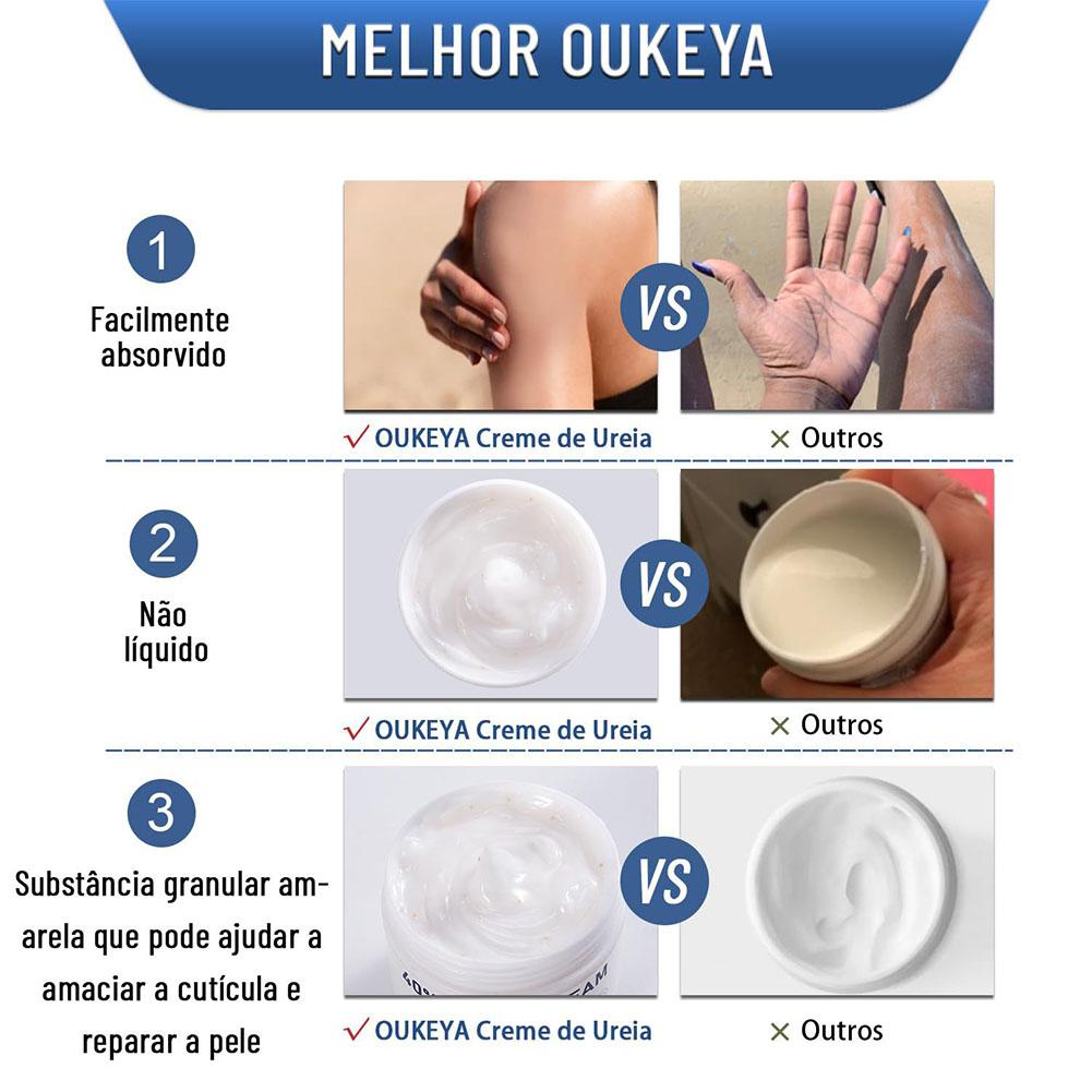 Urea Cream 40% Moisturizing An - Urea Foot Cream ulasan dan harga