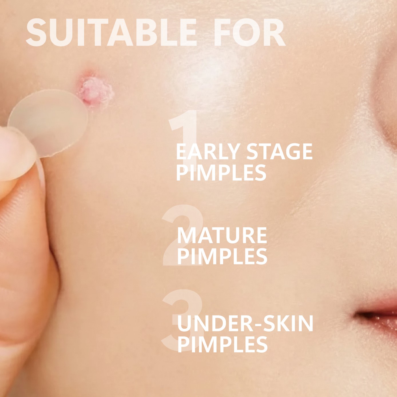 Micro Needle Pimple Patch (24  - Face Moisturizer ulasan dan harga